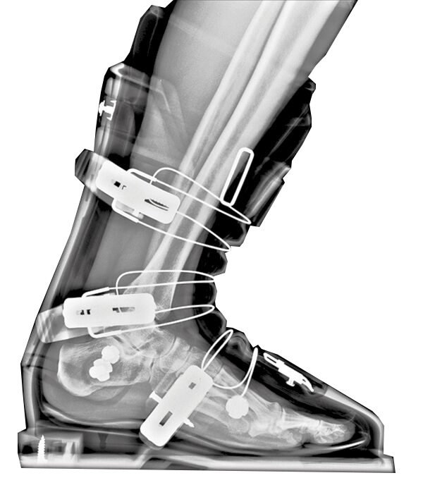Service de Bootfitting - Mountain ride Châtel
